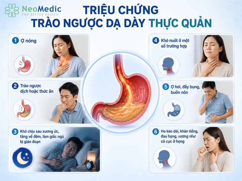 trieu-chung-trao-nguoc-da-day-thuc-quan