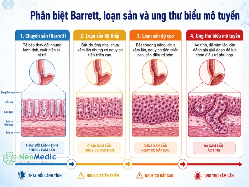 phan-biet-barrett-thuc-quan