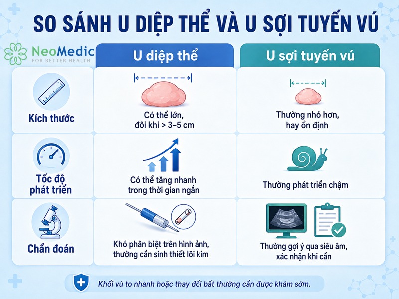 so-sanh-u-diep-the-tuyen-vu