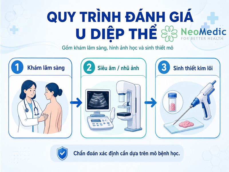 quy-trinh-danh-gia-u-diep-the-tuyen-vu