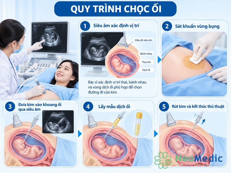 quy-trinh-choc-oi