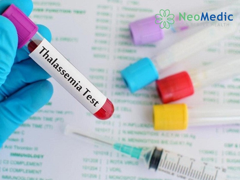 xet-nghiem-thalassemia