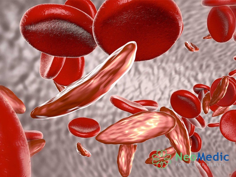xet-nghiem-thalassemia-xet-nghiem-gen