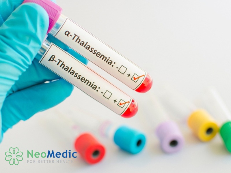 xet-nghiem-thalassemia-bao-nhieu-tien-cau-hoi