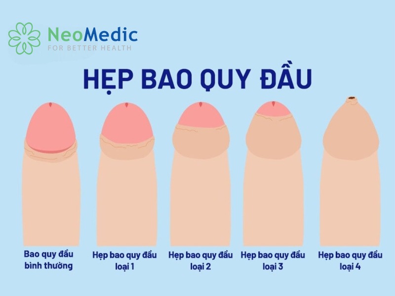 hep-bao-quy-dau-o-tre-em