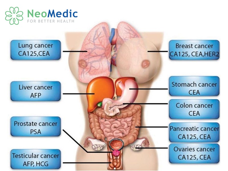 ung-thu-dai-truc-trang-biomarker