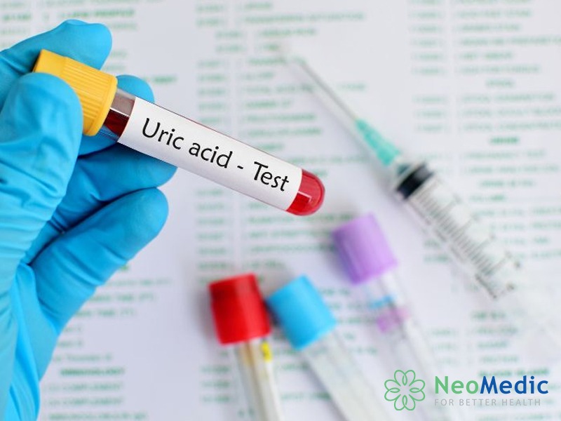 cach-doc-ket-qua-xet-nghiem-mau-tong-quat-acid-uric
