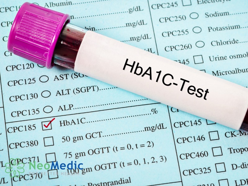 chi-so-hba1c-duoi-5-7