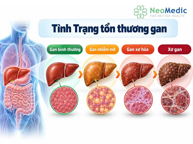 tinh-trang-ton-thuong-do-gan-nhiem-mo-do-1