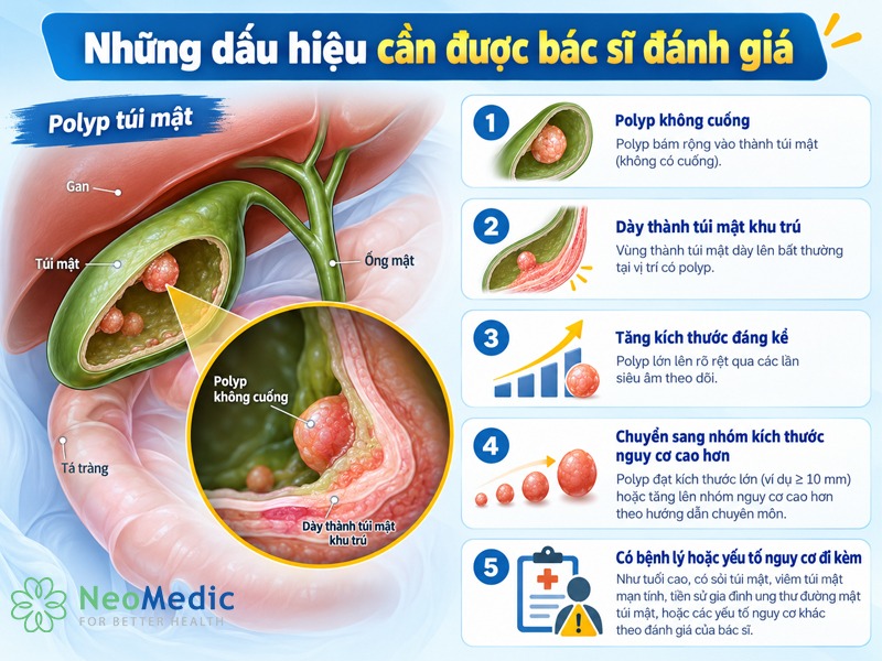 dau-hieu-polyp-tui-mat