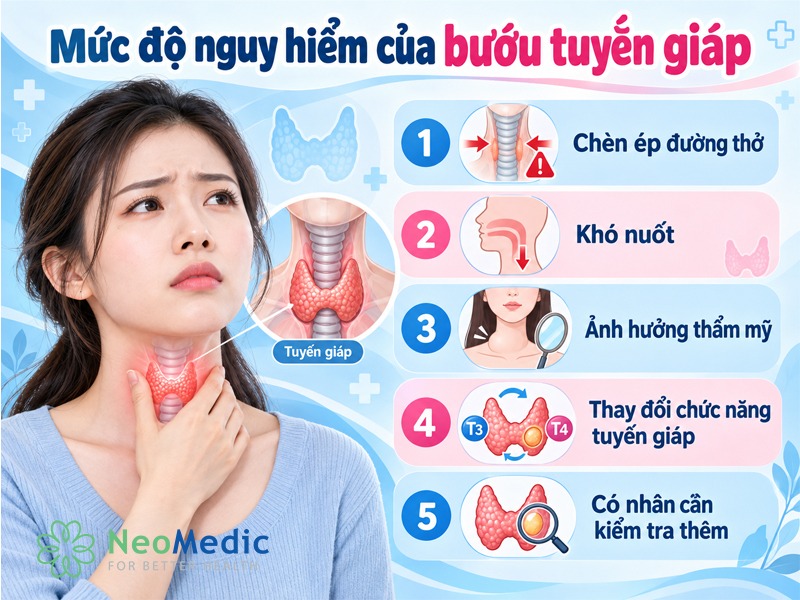muc-nguy-hiem-buou-giap-don-thuan