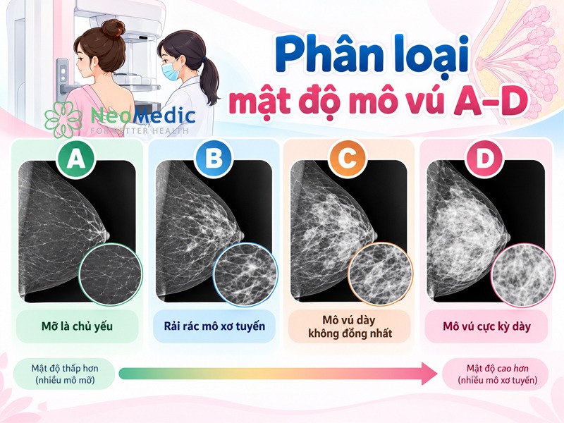 phan-loai-mo-vu-day