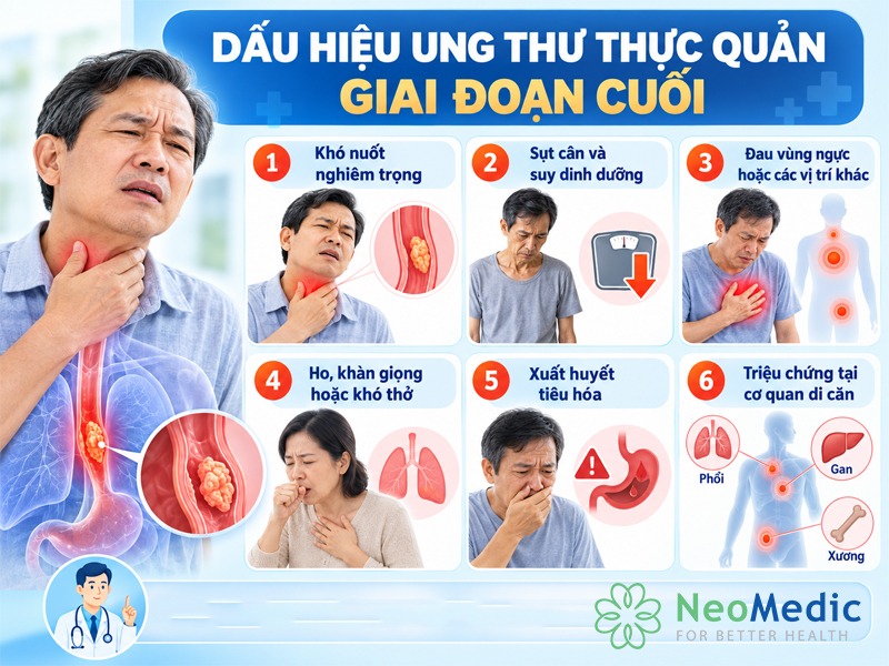 dau-hieu-ung-thu-thuc-quan-giai-doan-cuoi