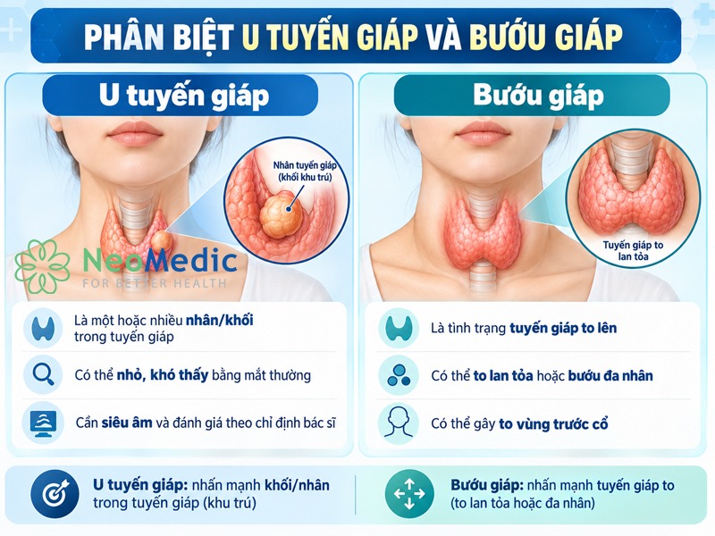 phan=biet-u-tuyen-giap-lanh-tinh 