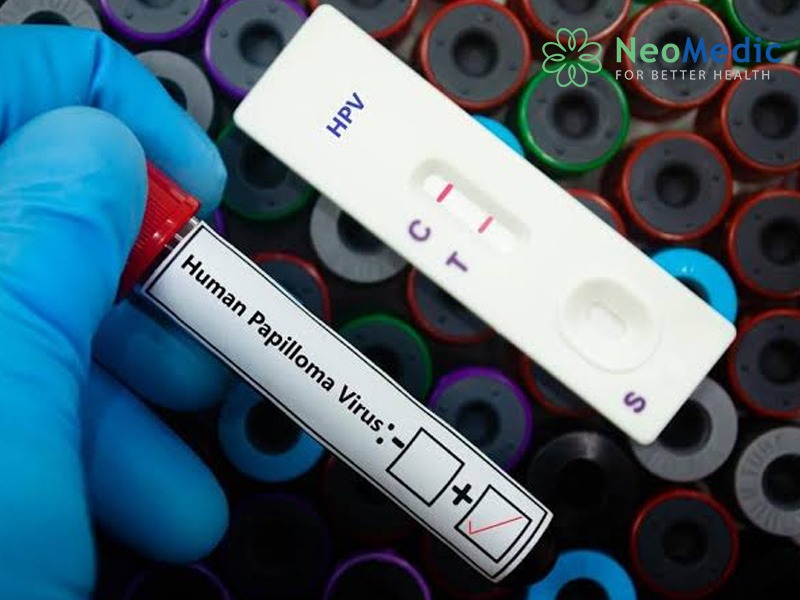 HPV-duong-tinh