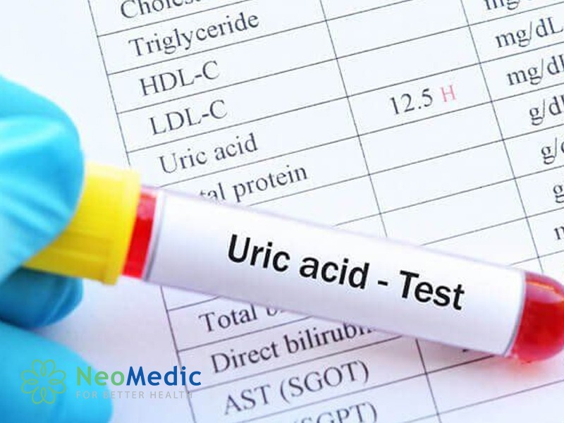 axit-uric-cao