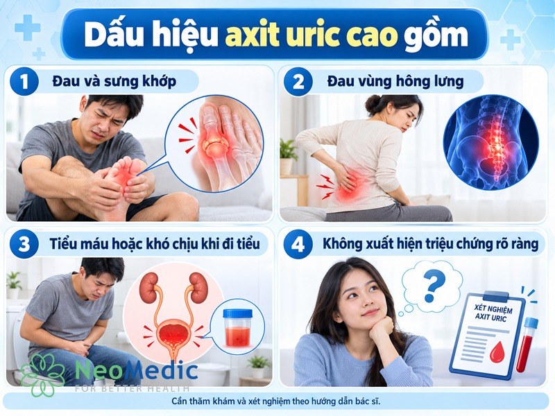 dau-hieu-axit-uric-cao