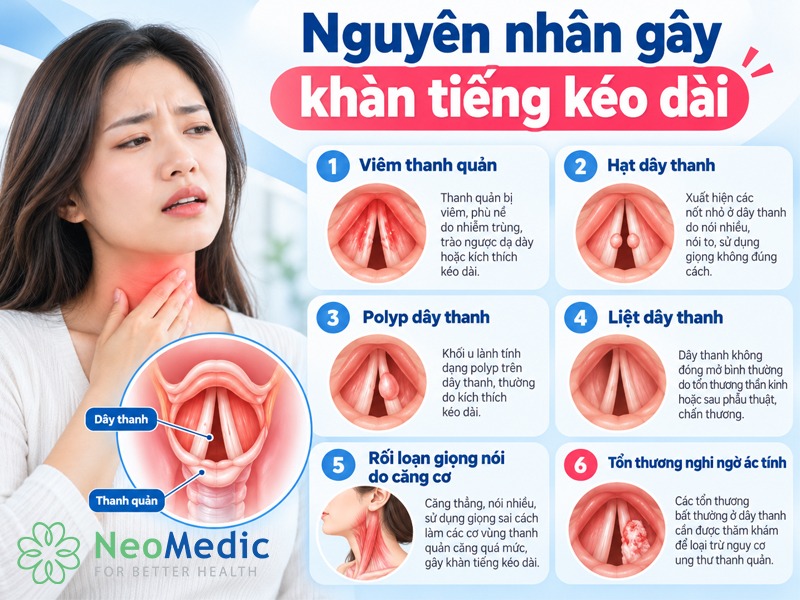 khan-tieng-keo-dai-bao-lau-thi-can-noi-soi-nguyen-nhan