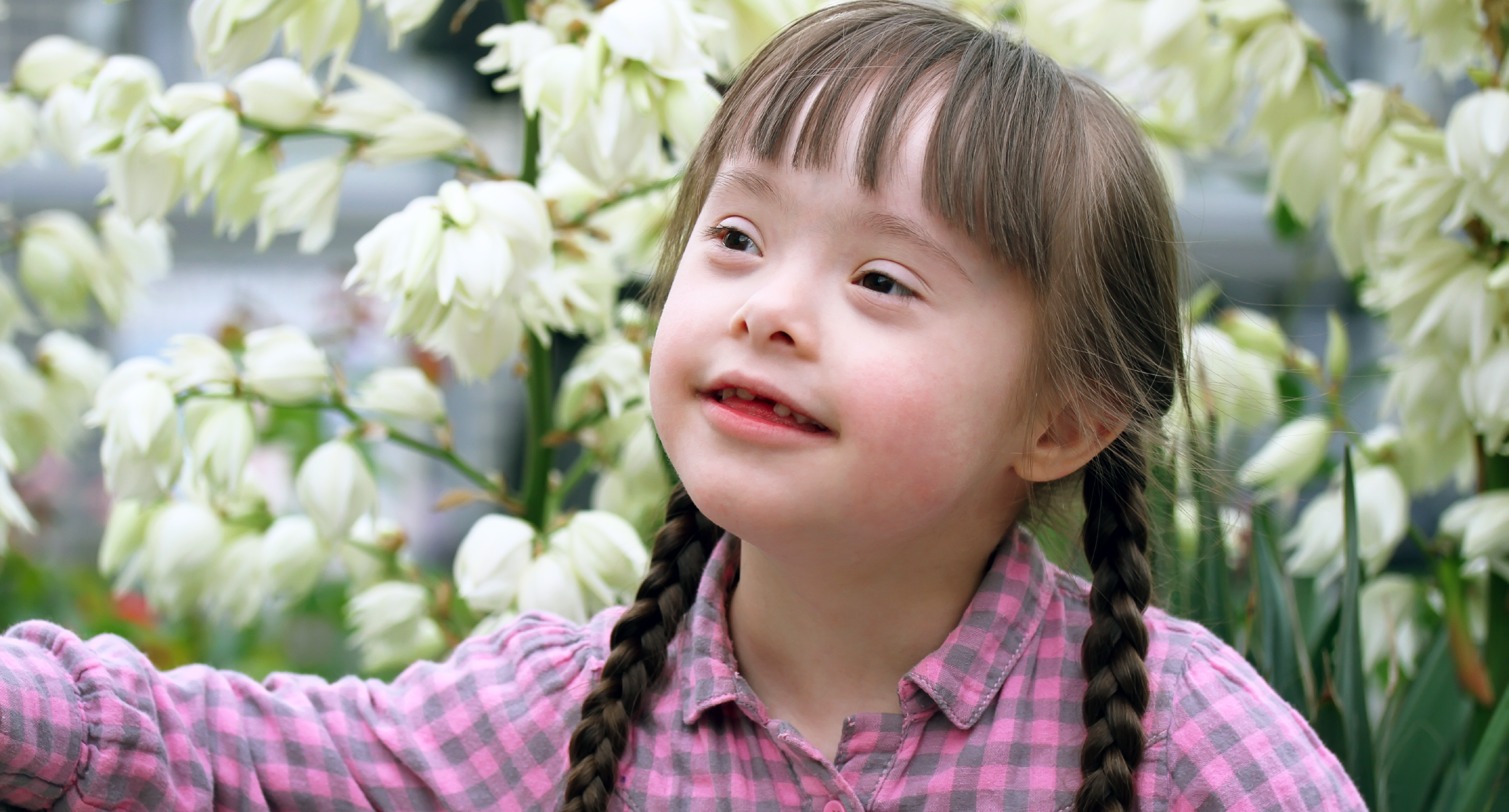 hoi-chung-down-la-gi-cac-cach-phat-hien-som-4