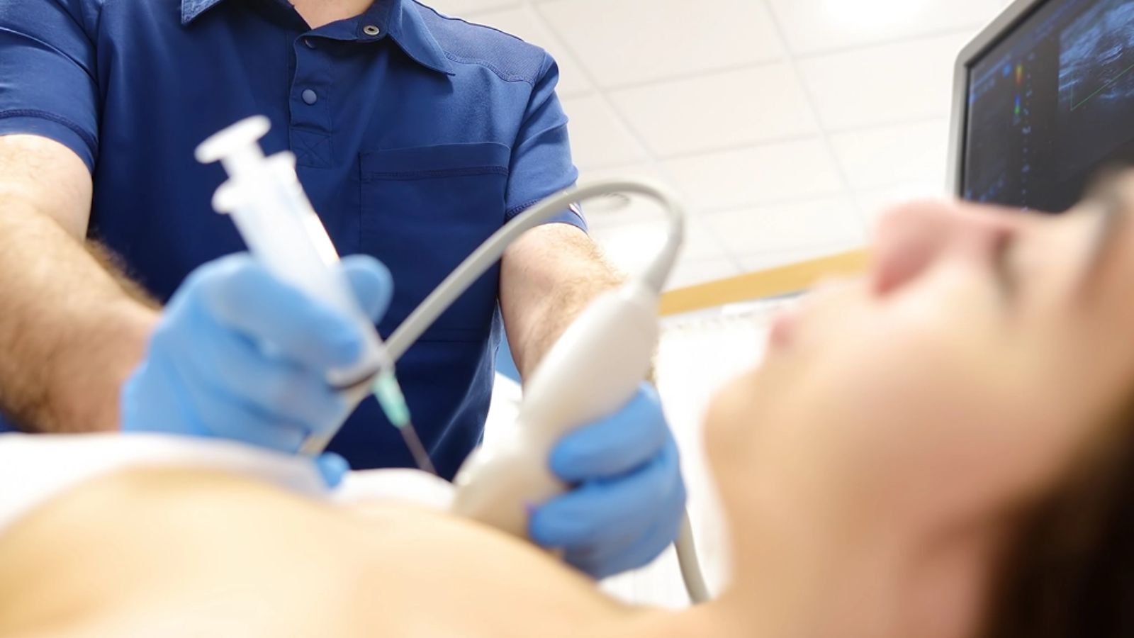 sinh-thiet-vu-duoi-huong-dan-sieu-am-3