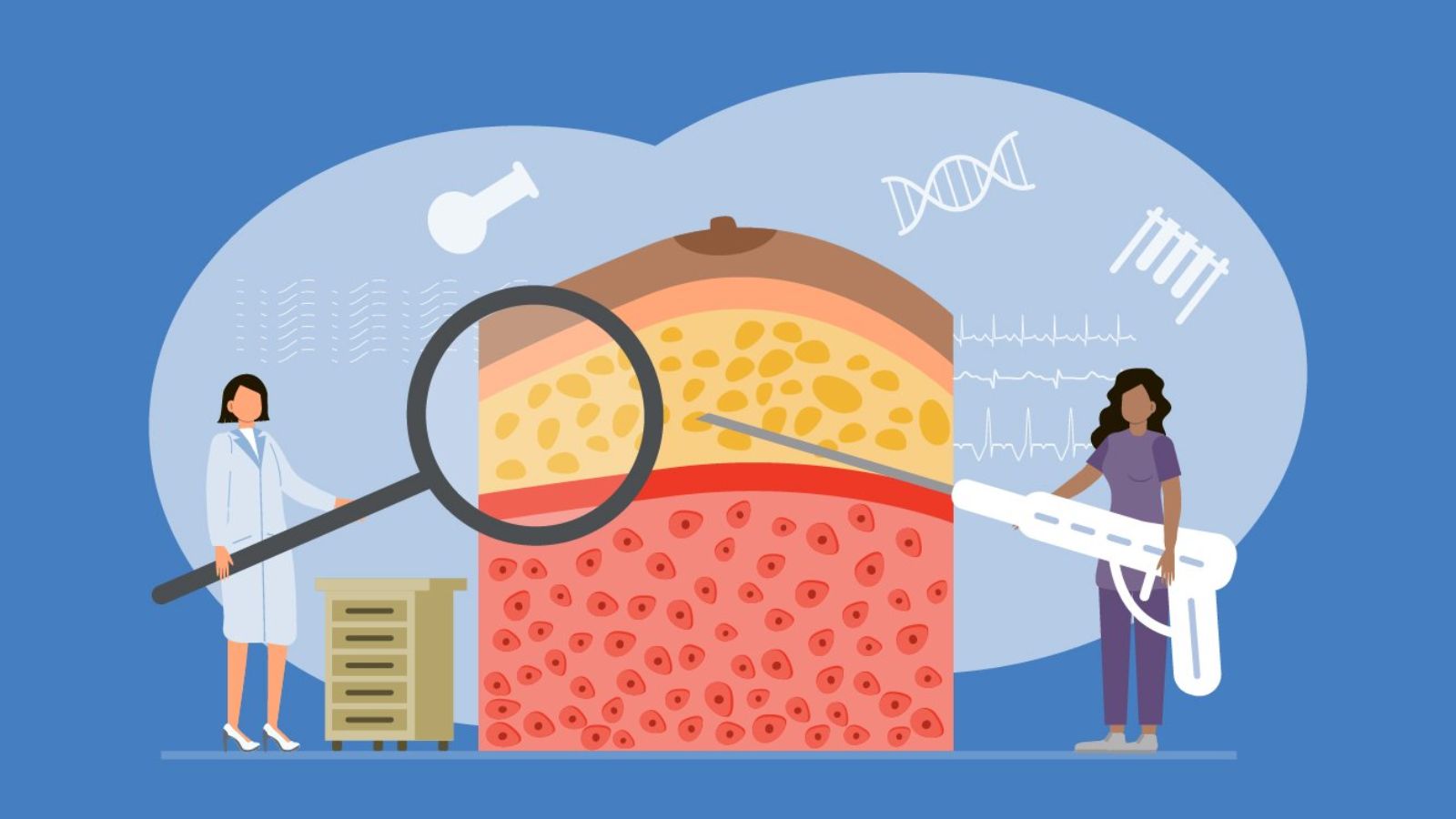 sinh-thiet-vu-duoi-huong-dan-sieu-am-6