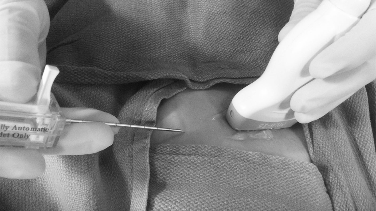 sinh-thiet-vu-duoi-huong-dan-sieu-am-4