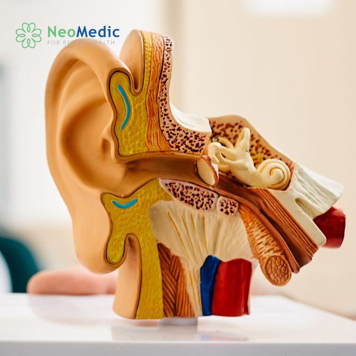 U thần kinh thính giác: Nguyên nhân, triệu chứng và cách điều trị