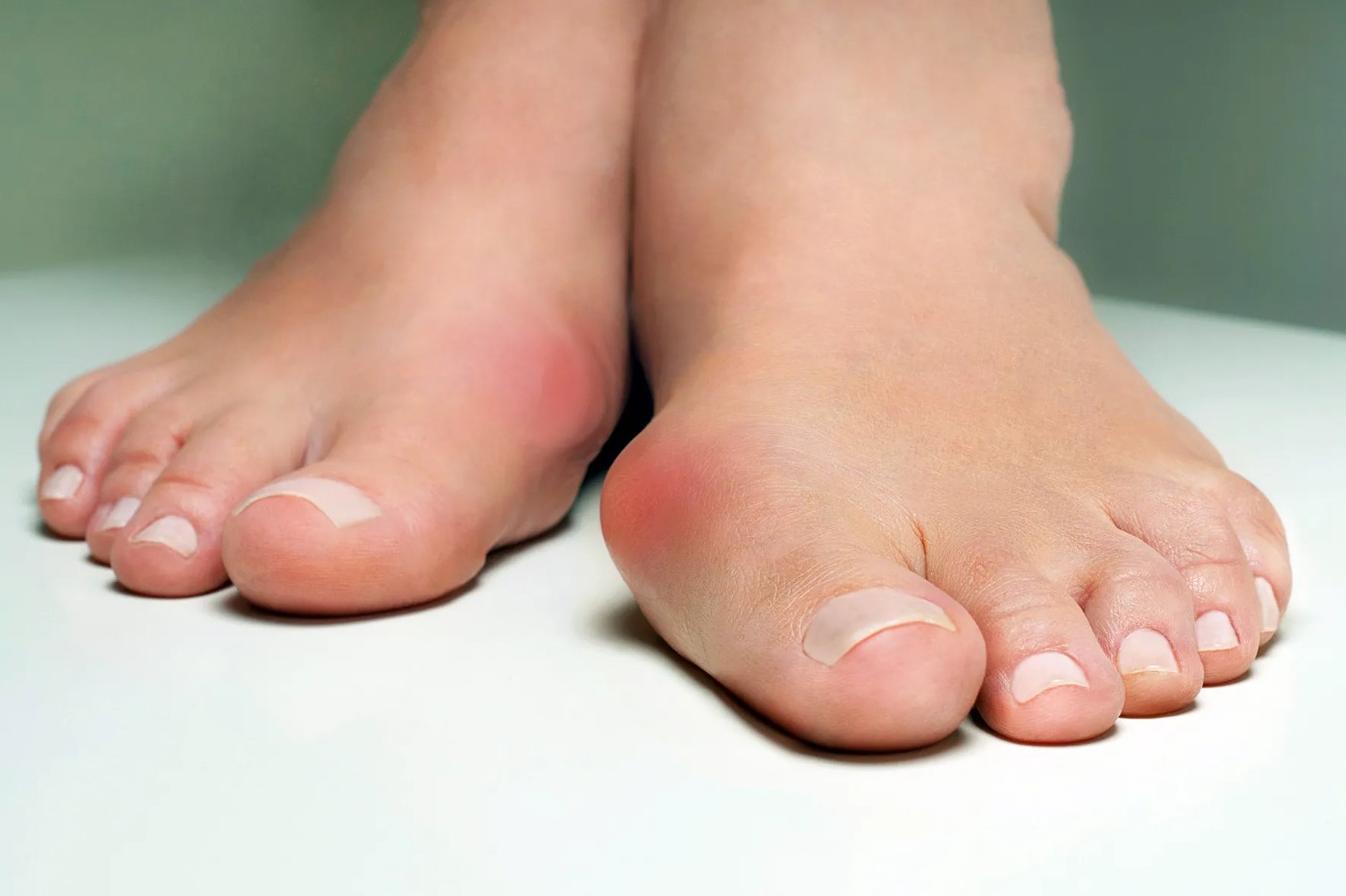 viem-bao-hoat-dich-ngon-chan-cai-1