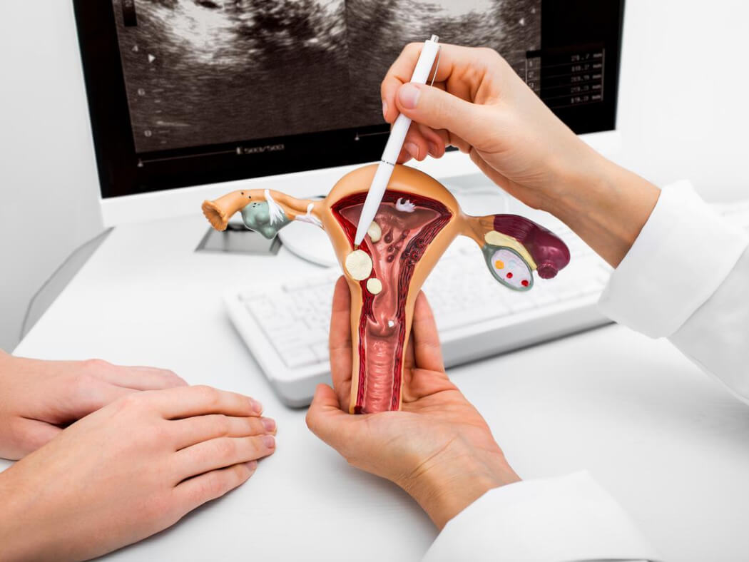 sang-loc-ung-thu-co-tu-cung-2