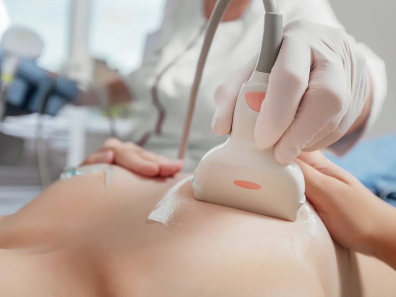 nen-sieu-am-vu-bao-lau-1-lan-5