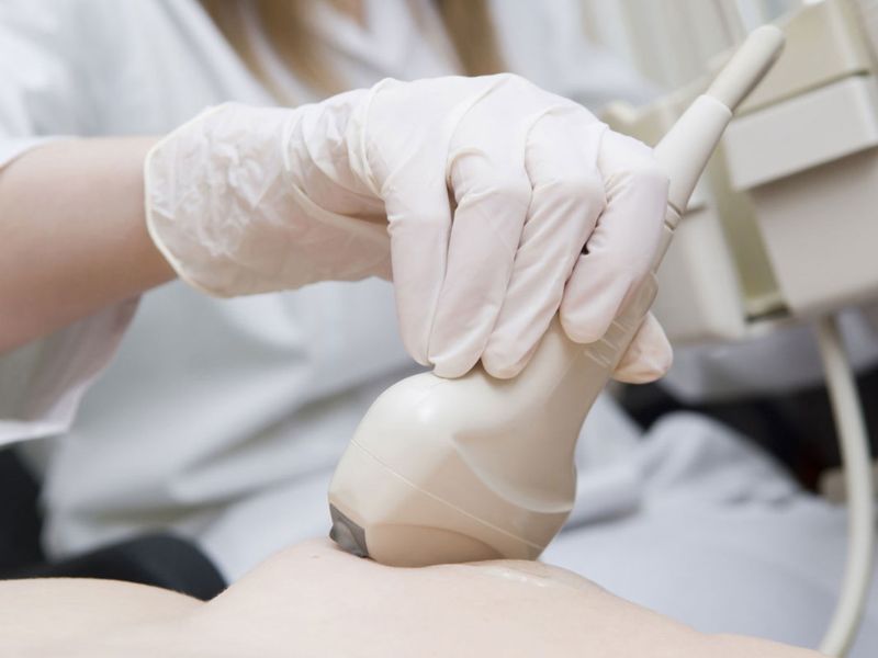 nen-sieu-am-vu-bao-lau-1-lan-3