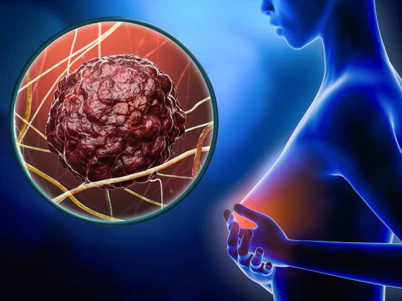 ung-thu-vu-HER2-am-tinh-va-ung-thu-vu-HER2-duong-tinh-2