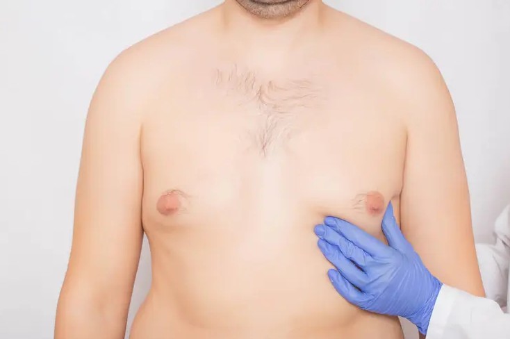 phau-thuat-cat-bo-toan-bo-tuyen-vu-3