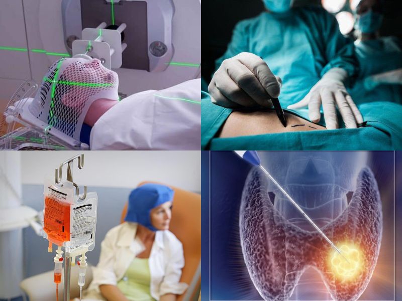 ket-qua-sieu-am-tuyen-giap-tirads-3-5