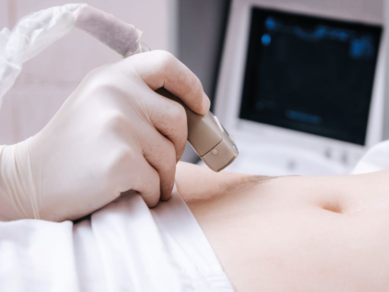 sieu-am-o-bung-phat-hien-nhung-benh-gi-3