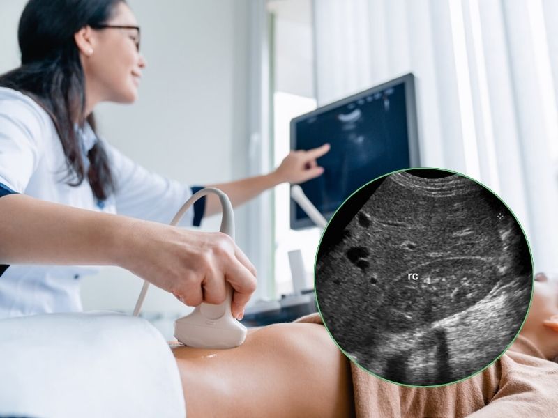 sieu-am-gan-nhiem-mo-3