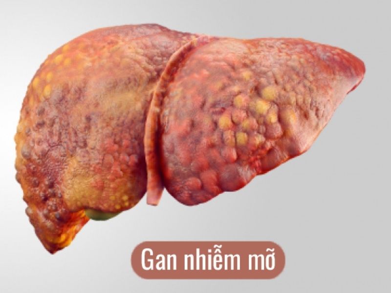 sieu-am-gan-nhiem-mo-2