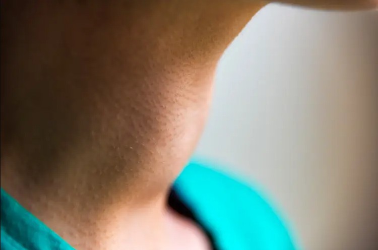 ung-thu-tuyen-giap-nguyen-nhan-cach-dieu-tri-2