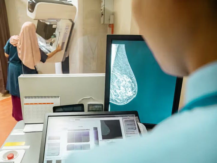 ung-thu-vu-xam-lan-ung-thu-vu-di-can-1