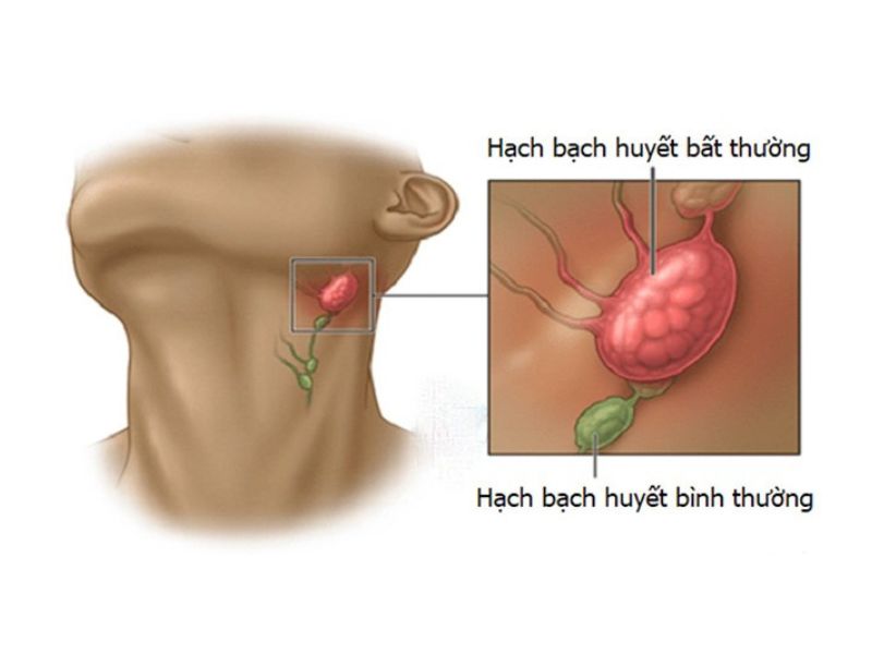 sieu-am-vung-co-co-tac-dung-gi-4