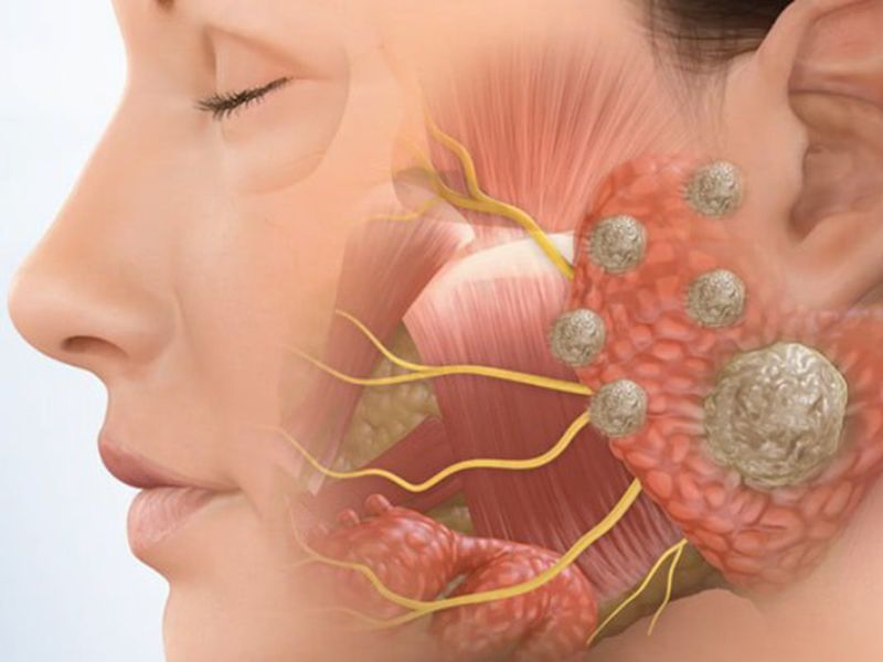 sieu-am-vung-co-co-tac-dung-gi-7