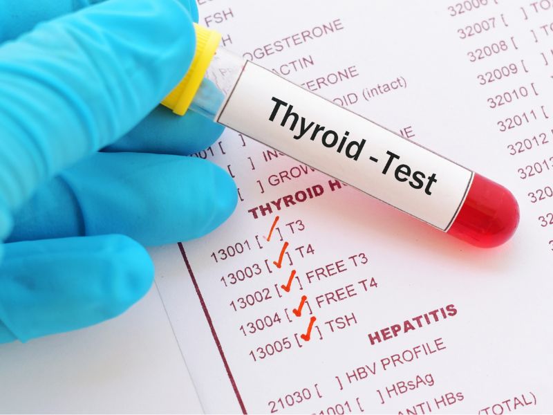 xet-nghiem-ung-thu-tuyen-giap-3