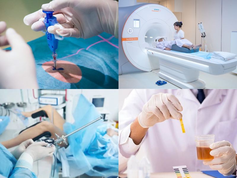 sieu-am-co-phat-hien-ung-thu-bang-quang-4