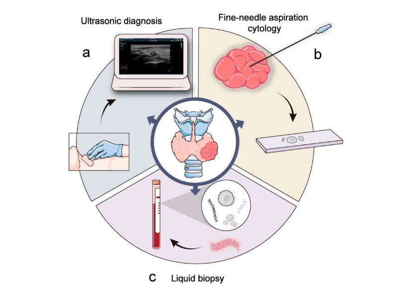 xet-nghiem-ung-thu-tuyen-giap-2