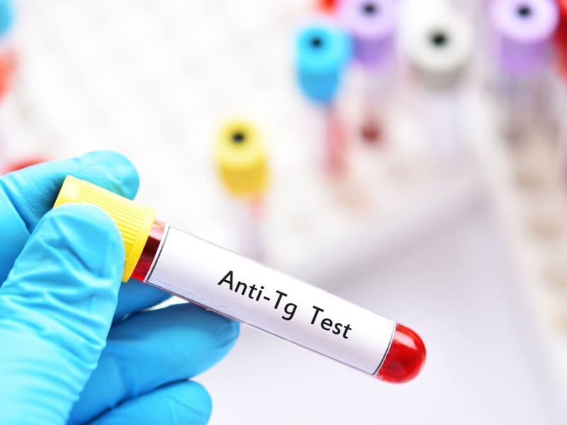 xet-nghiem-ung-thu-tuyen-giap-4