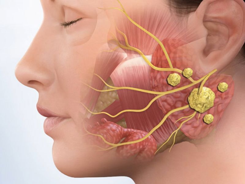 sieu-am-tuyen-nuoc-bot-mang-tai-3