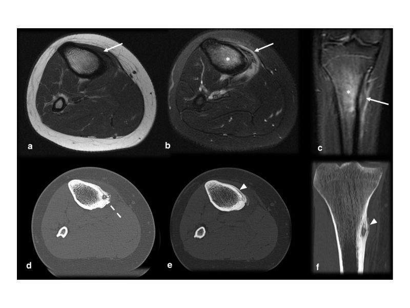 u-xuong-dang-xuong-2