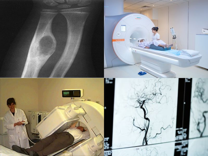 u-xuong-dang-xuong-6