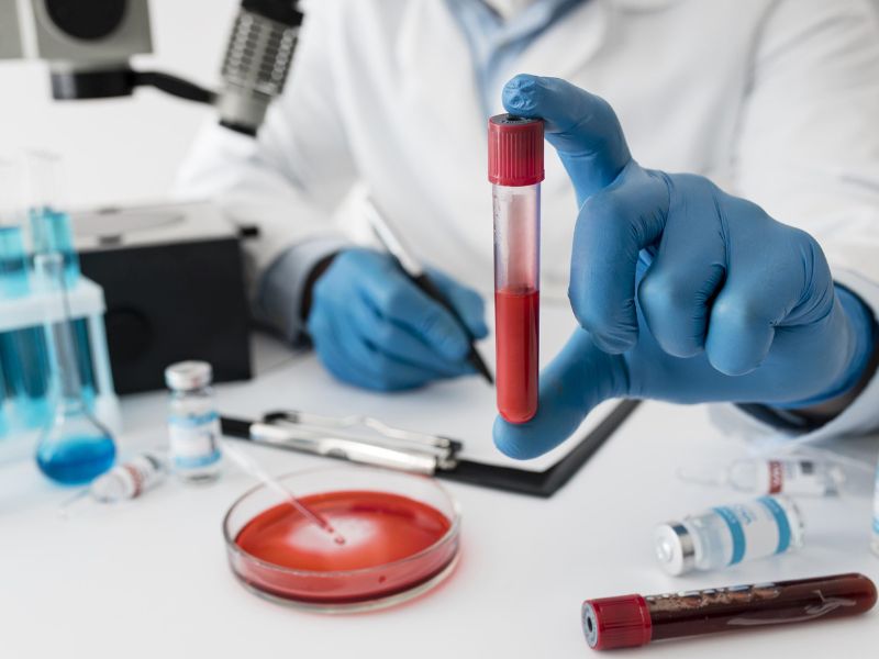 xet-nghiem-ung-thu-vu-5