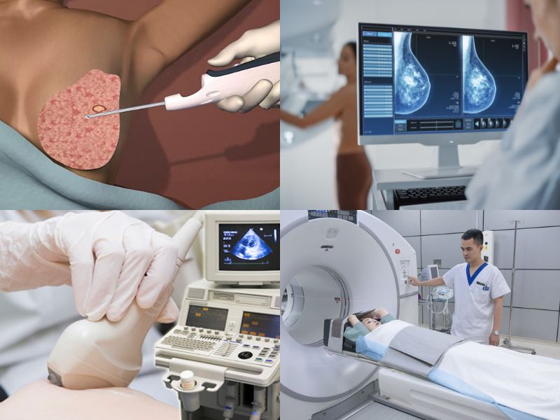 tam-soat-ung-thu-vu-4